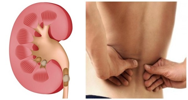 Cellular Hydration – KIDNEY SUPPORT – Herbal Flush 2 Bottles 120 Capsules