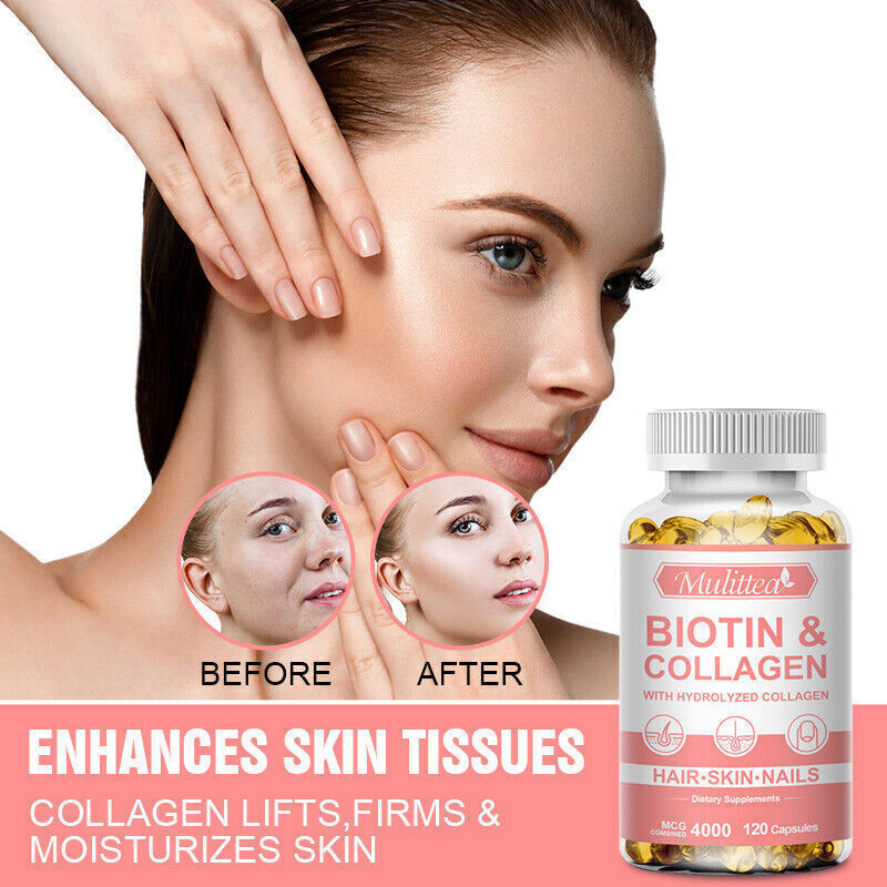 Collagen Hydrolysate with Biotin Vitamin C Support Healthy Hair Skin Nails