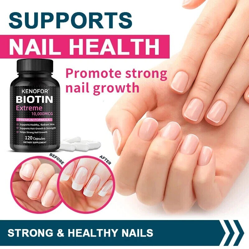 Biotin 10,000 Mcg Maximum Strength High Potency Hair Skin & Nails –