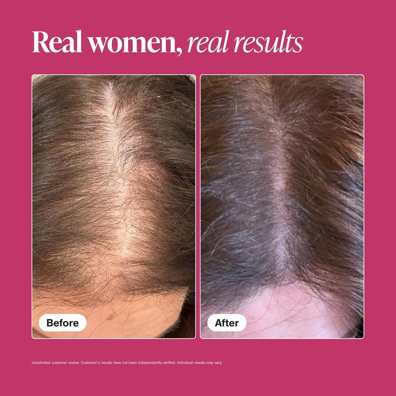 Viviscal Pro Professional Hair Growth Supplement 180 tablets For Men and Woman