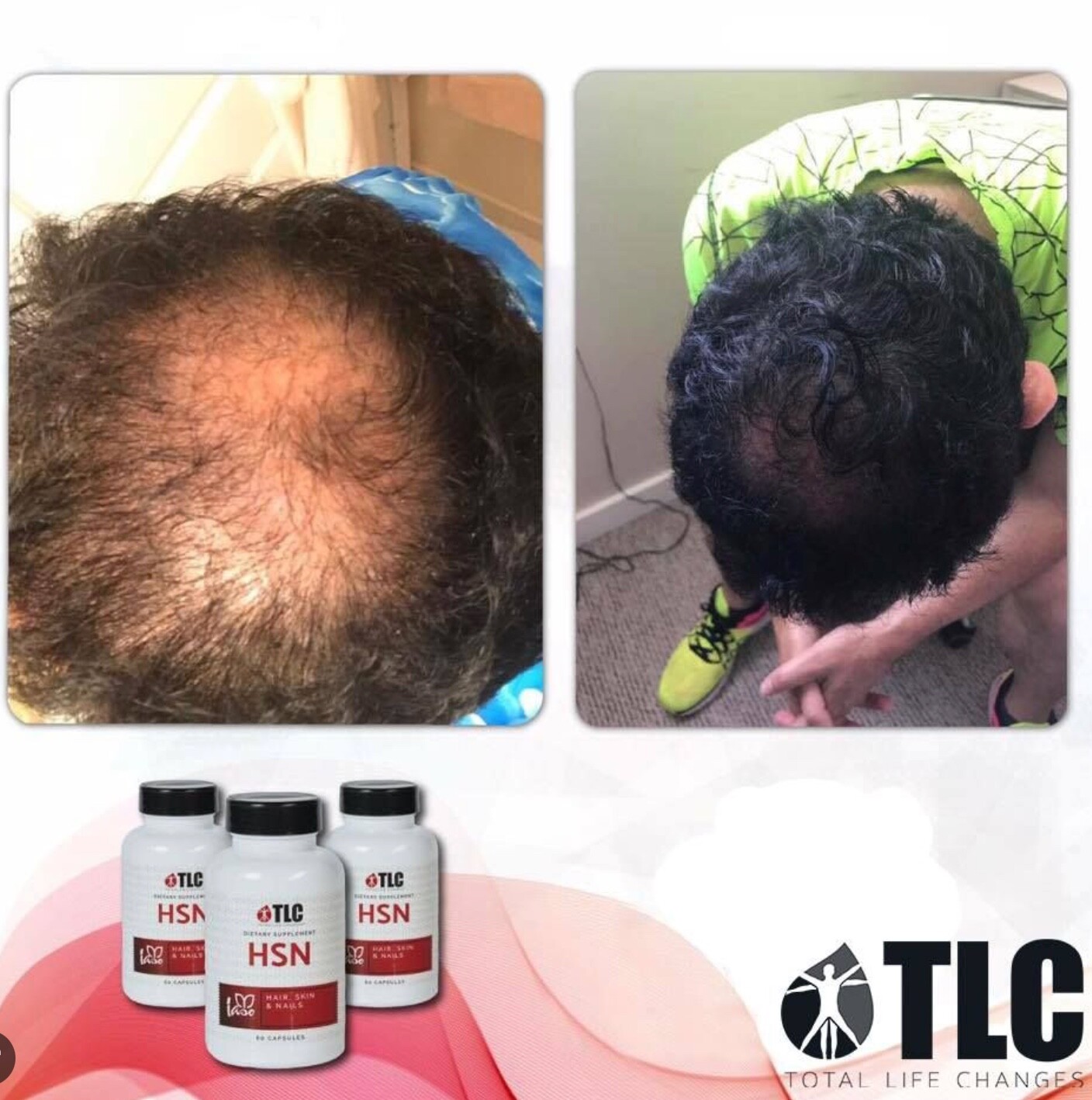 HSN Total Life Changes