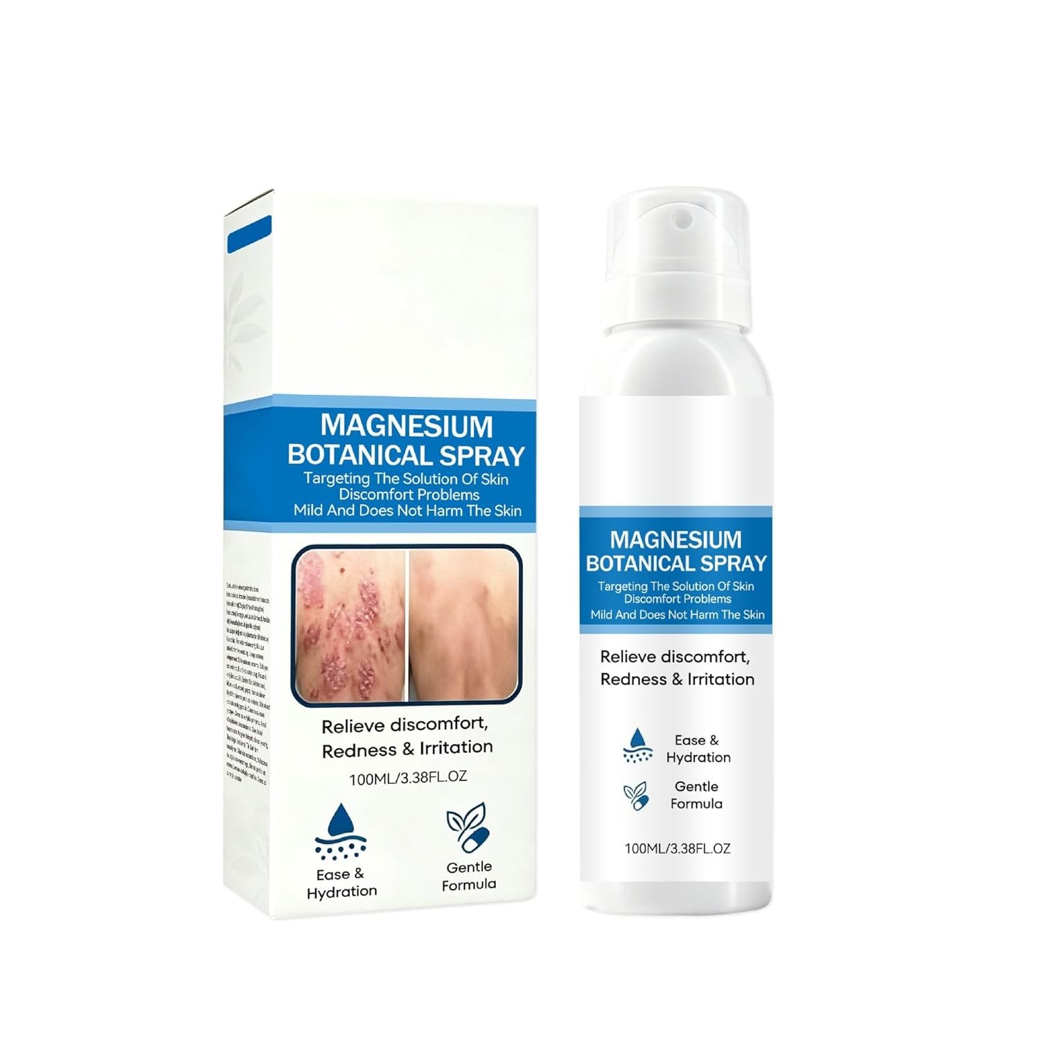Magnesium Herbal Skin Soothing Spray For Redness, Irritation & Discomfort