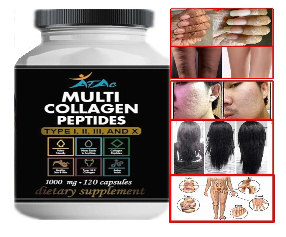 100% Natural Multi Collagen Peptides Anti Aging Skin Collagen Pills 120 capsules