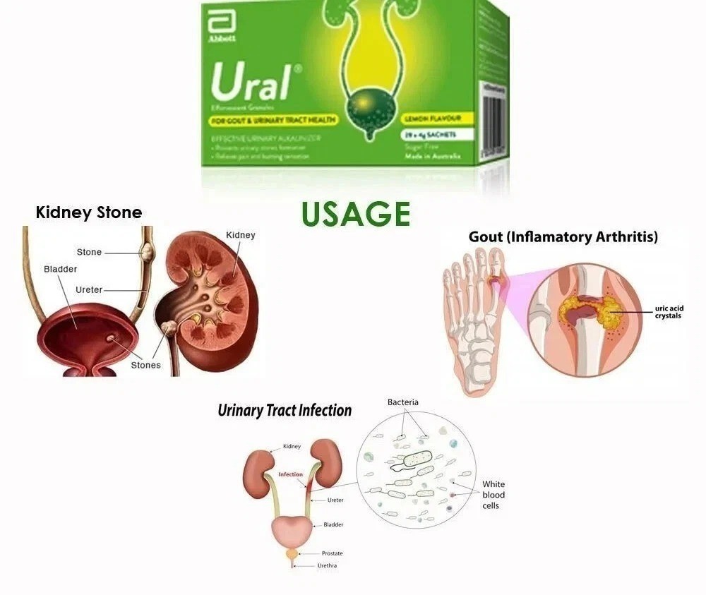 New Abbott Ural Effervescent Granules Urine Alkalinizer 4g x 28 Sachets Relief