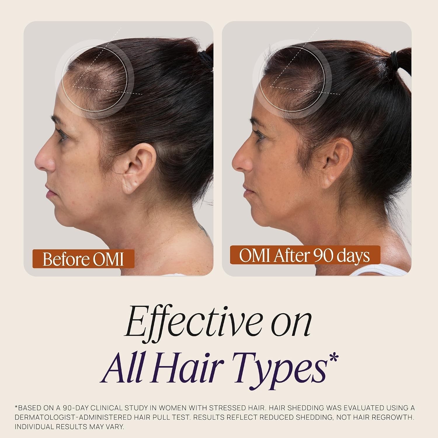 OMI Peptides Hair Growth Gummies Women Patented Follicle Fortifying Wild Berry