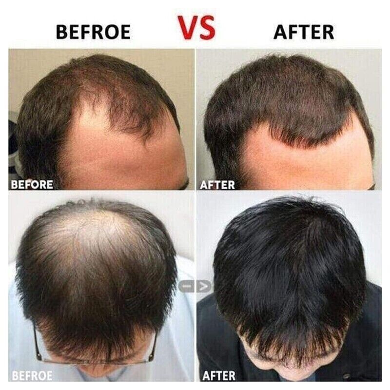 FAST HAIR GROWTH BOOSTER SUPPLEMENT GROW FASTER LONGER THICKER FULLER 60 Capsule