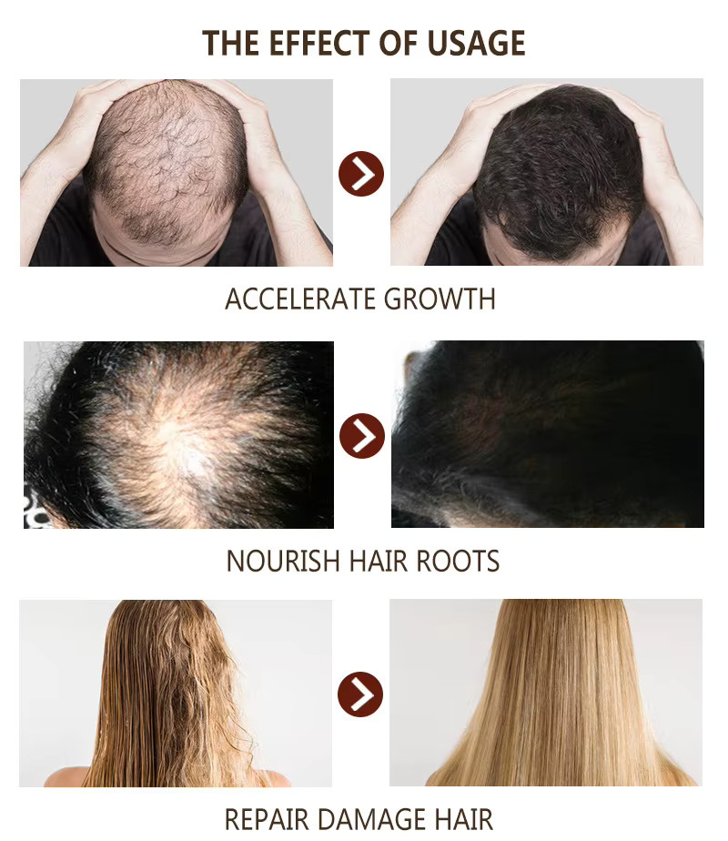 Hair Growth Support Kit Capilar Capsules & Herbal Scalp Oil for Thicker Hair