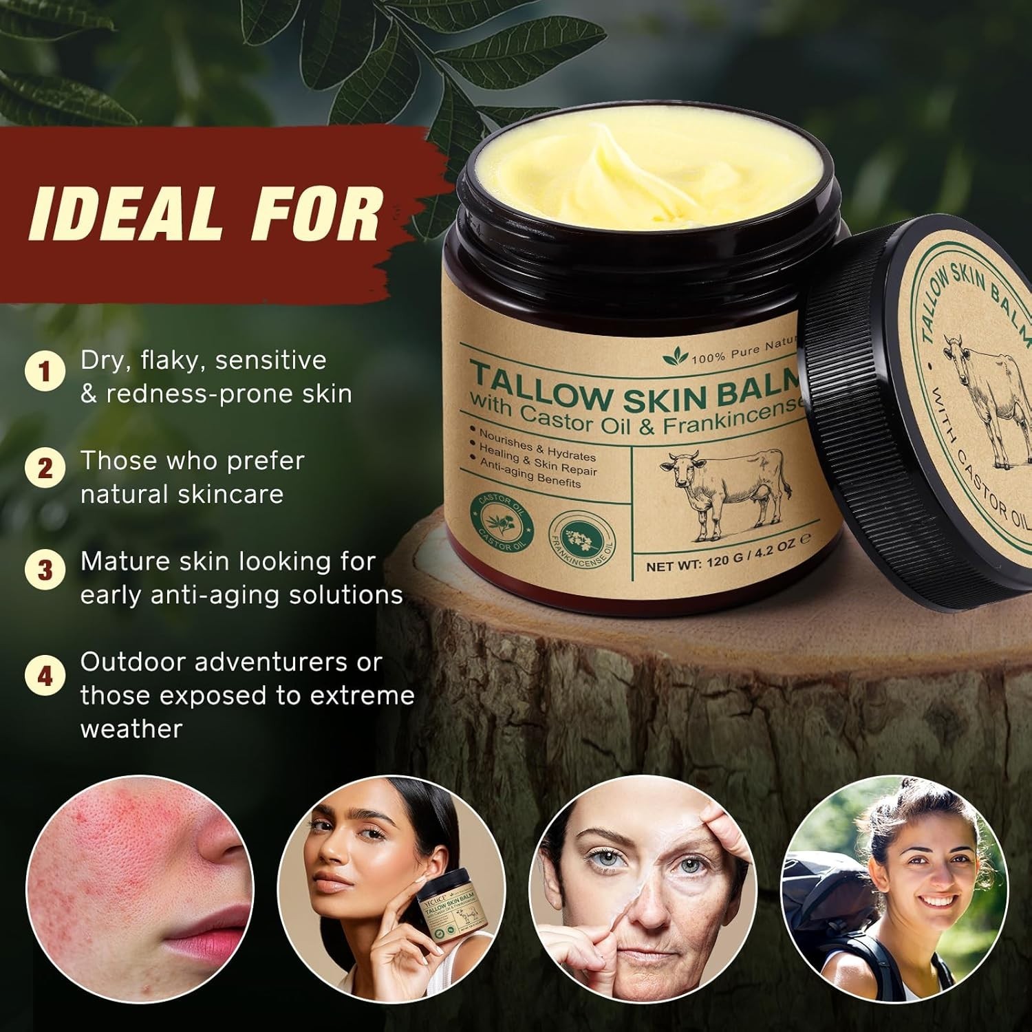 2 Pcak Beef Tallow Cream with Castor Oil and Frankincense, 100% Grass-Fed Tal…