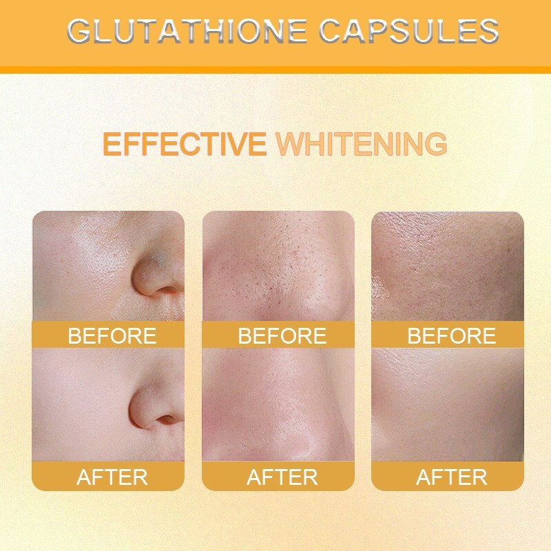 L-Glutathione Capsules 1000MG For Anti-Aging Skin Whitening Antioxidant