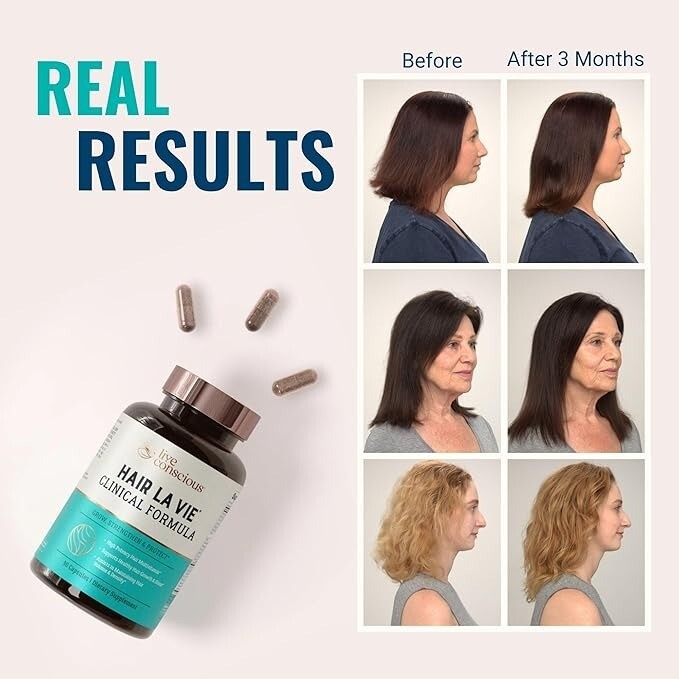 Hair La Vie Clinical Formula Hair Vitamins with Biotin & Saw PalmettoExp 04/2027