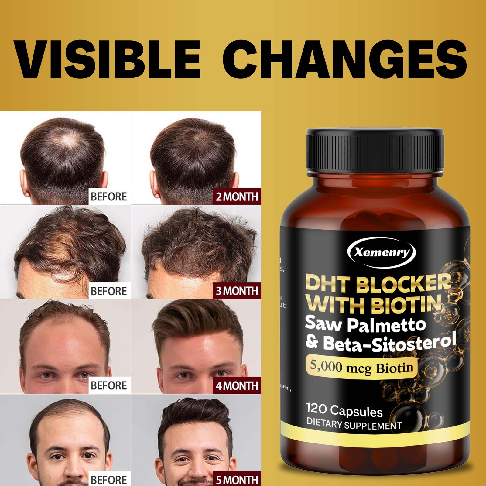 DHT Blocker – Saw Palmetto,Promotes Healthy Hair Growth and Urinary Tract Health