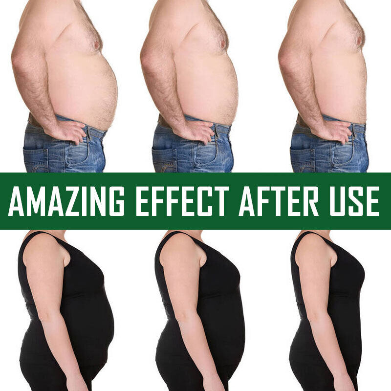 GARCINIA CAMBOGIA Extract – 95% Natural HCA with ACV 3000mg – Fast Weight Loss
